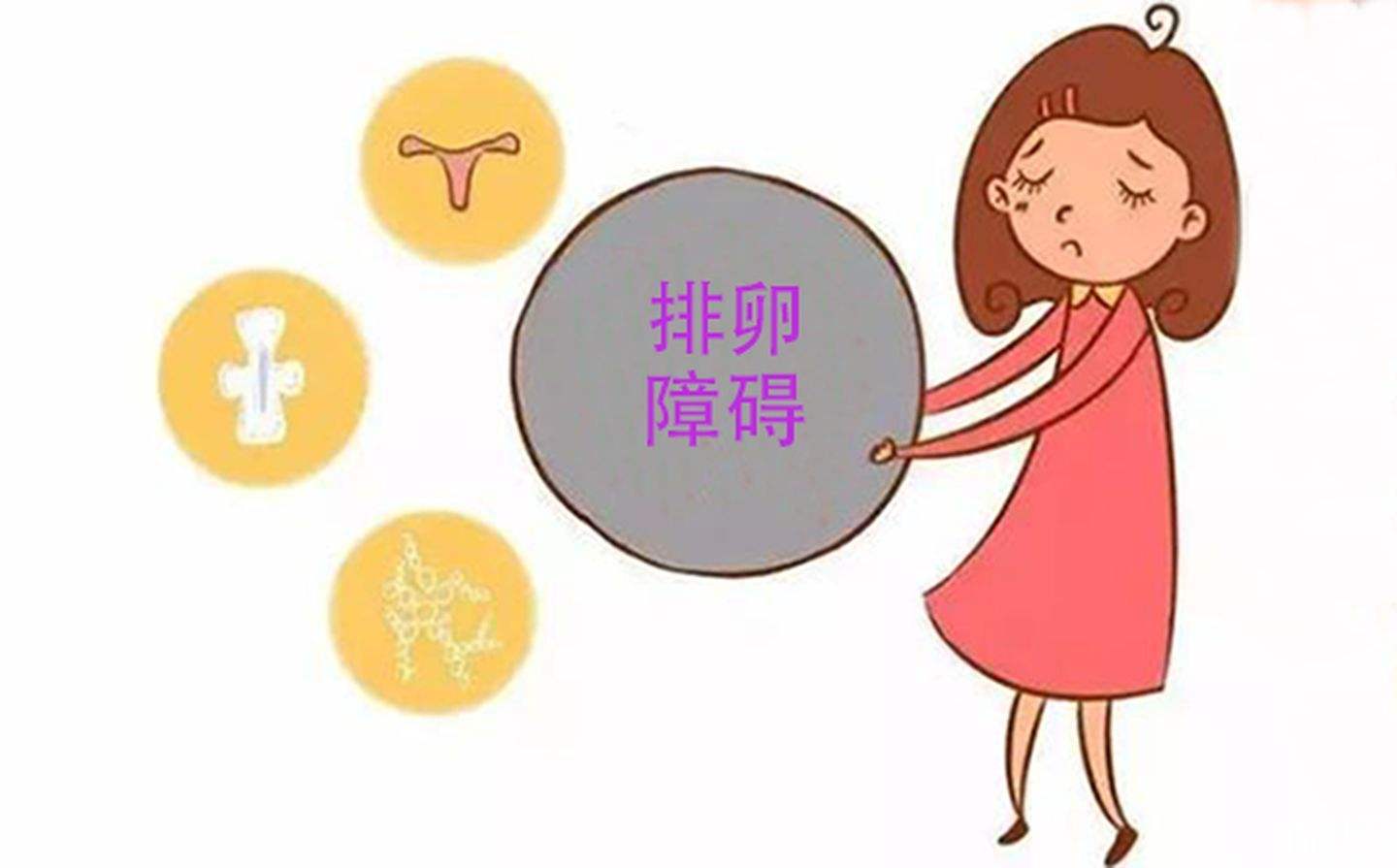 排卵障碍